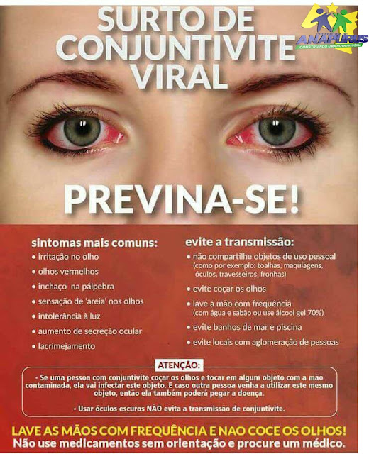 Espaço Vip. Conjuntivite Viral Saiba como identificar e tratar a doença