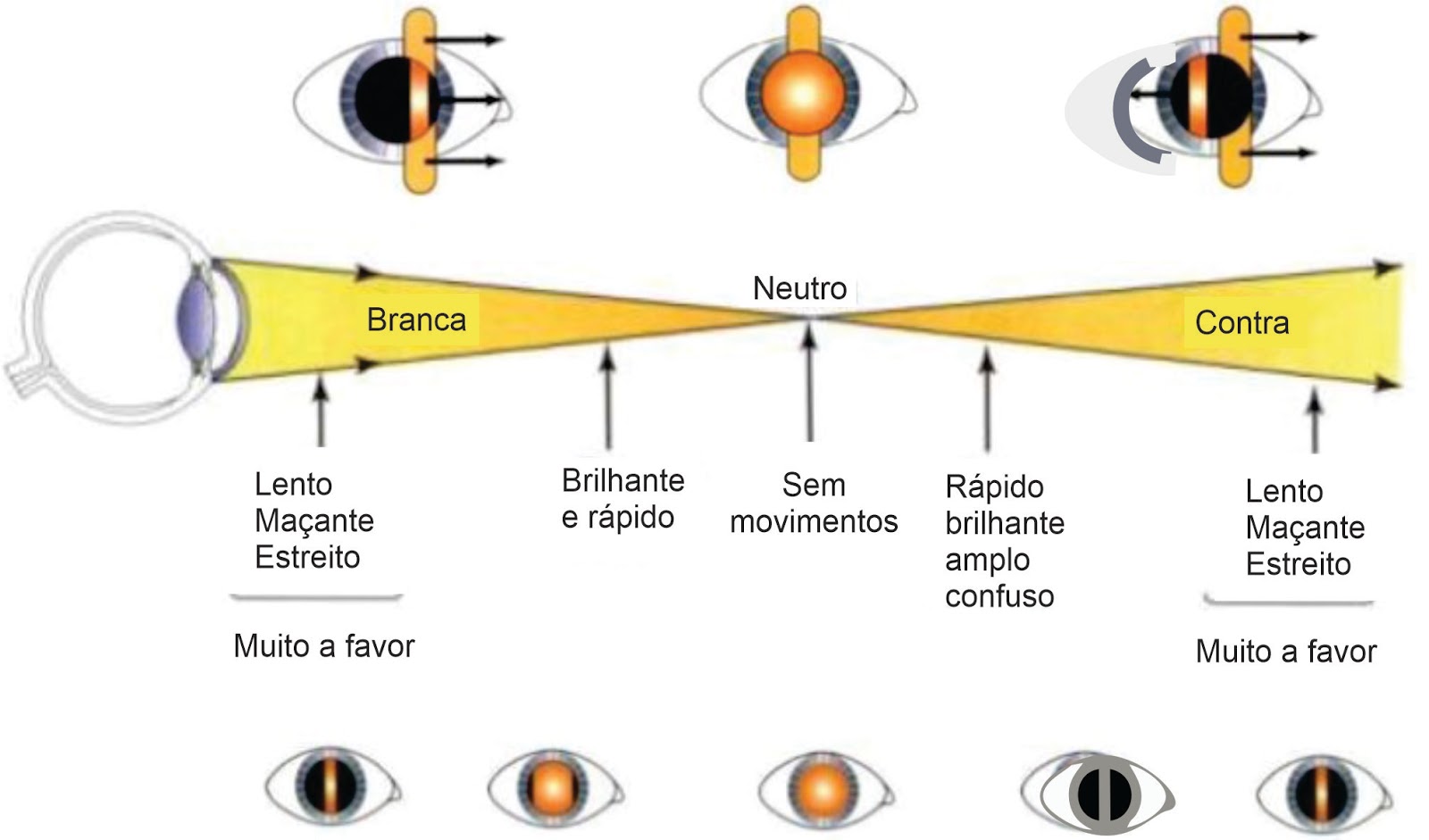 Optometria in Foco Retinoscopia estática