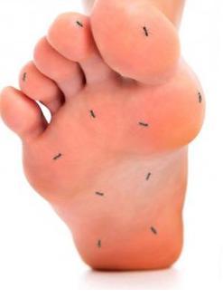 Kenapain: Kenapa kita kesemutan