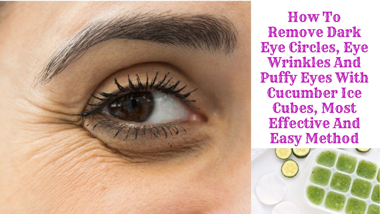 How To Remove Dark Eye Circles, Eye Wrinkles And Puffy Eyes With Cucumber Ice Cubes, Most