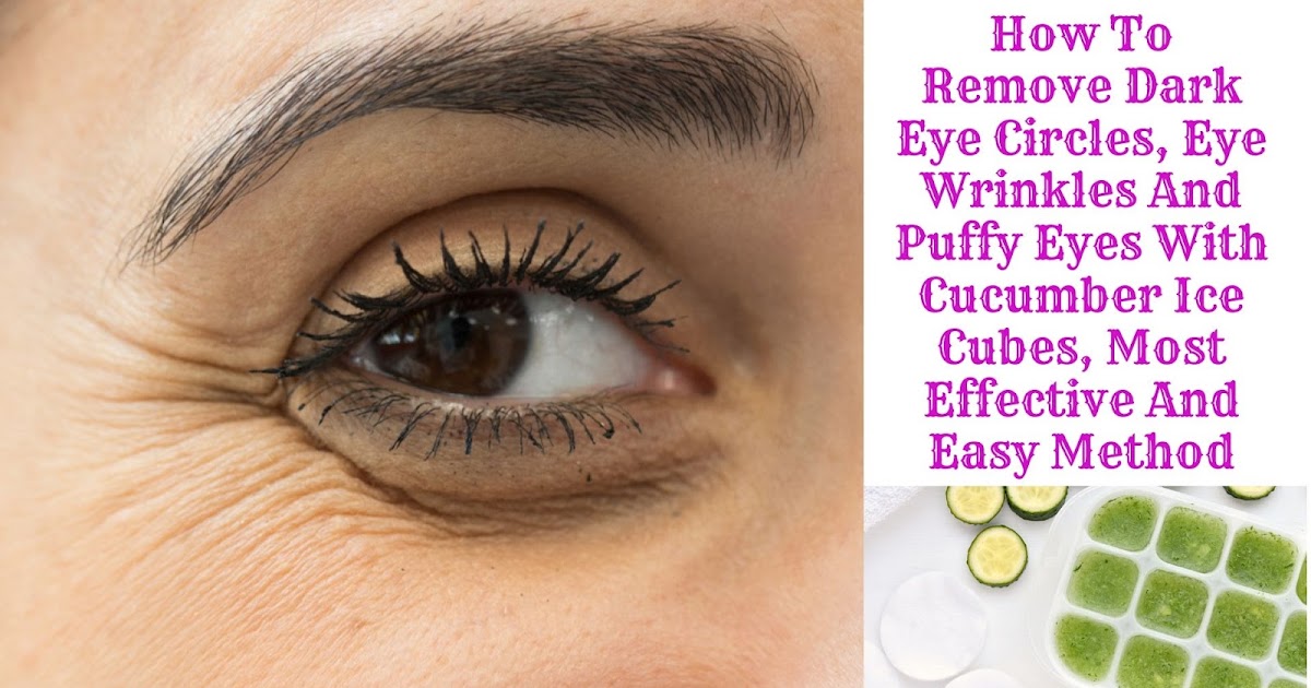 How To Remove Dark Eye Circles, Eye Wrinkles And Puffy Eyes With