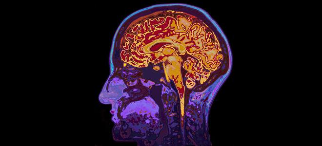 Αποδίδει καρπούς η συνεργασία Roche με την μονάδα Inception Sciences ...