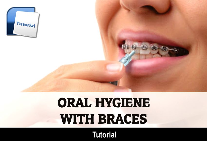 ORAL HYGIENE with Braces OdontoFarma