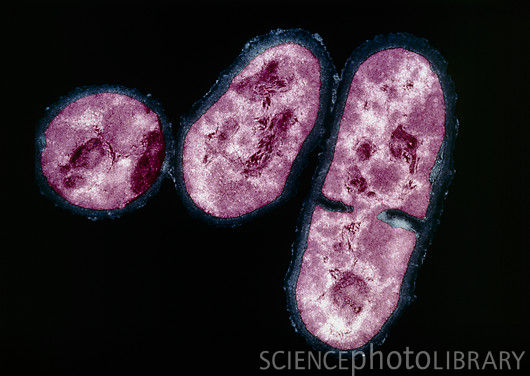 Propionibacterium acnes - Wikipedia