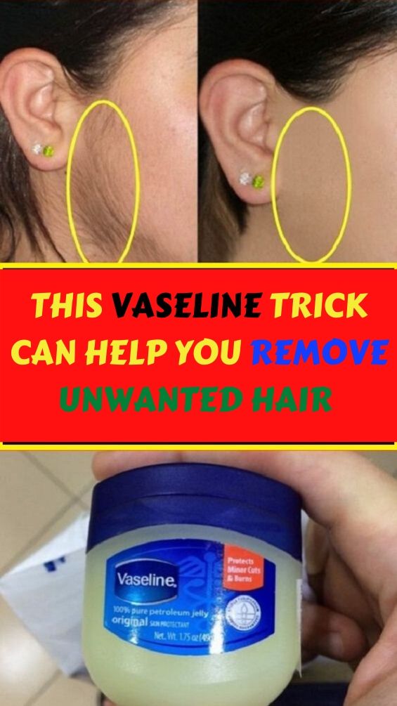 Just Vaseline Trick Can Help You Remove Unwanted Hair SKINCARE