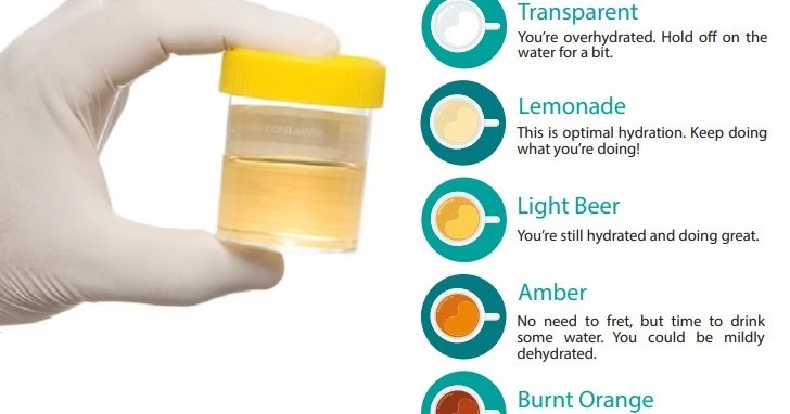 Urine color chart