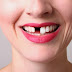 Trồng răng cửa có đau không? Bác sĩ tư vấn
