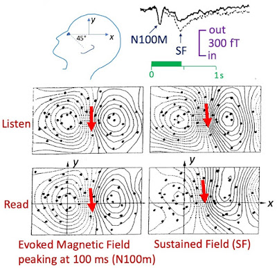 Reproduction of Fig 47 from Hämäläinen et al. (1993), showing an auditory evoked magnetic field from the brain.