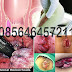 Obat Wasir AmbeJOSS Alami Tanpa Operasi thumbnail