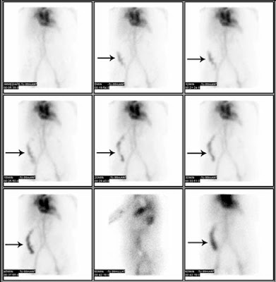 In Nuc,We Trust: How Nuclear Medicine Works