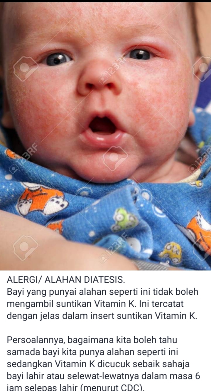 Masyarakat Kena Tahu Suntikan Vitamin K Untuk Bayi Seawal 6 Jam