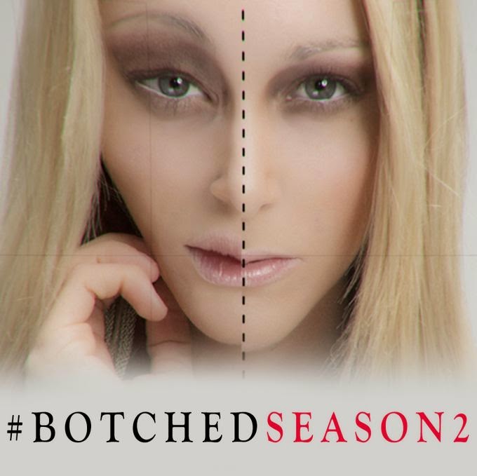 Botched Renewed For A Second Season 