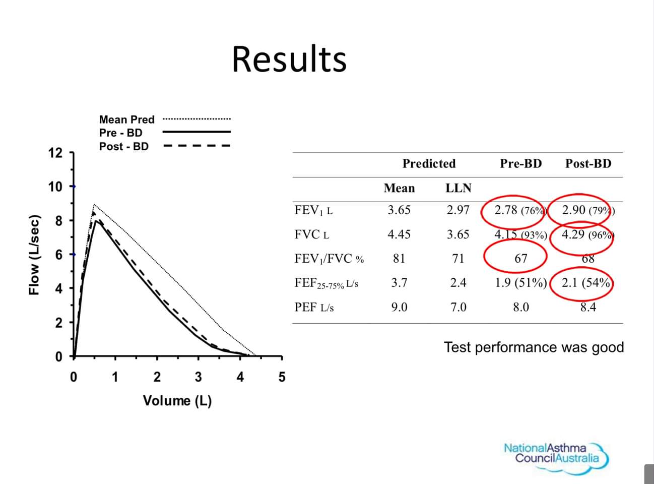 Spirometry MEDICAL NOTES