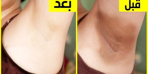 قهوة غوستو لتفتيح المناطق الحساسة