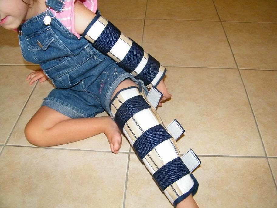 Sensory care Paediatric Services: Watch that Splint