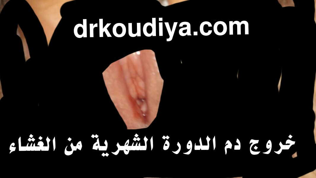 كيف اعرف ان الغشاء انفتح