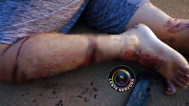 Suspeitos ficam gravemente feridos ao atingirem viatura da polícia durante fuga – VEJA O VÍDEO