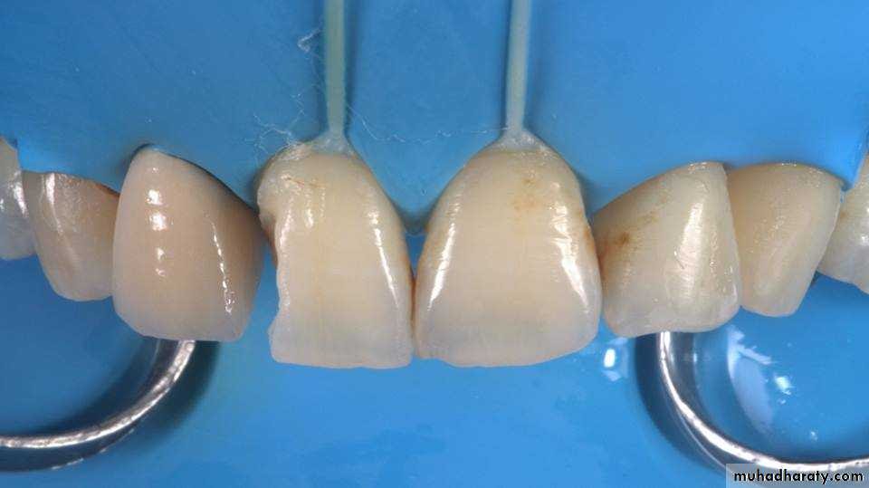 Isolation in operative dentistry (10)