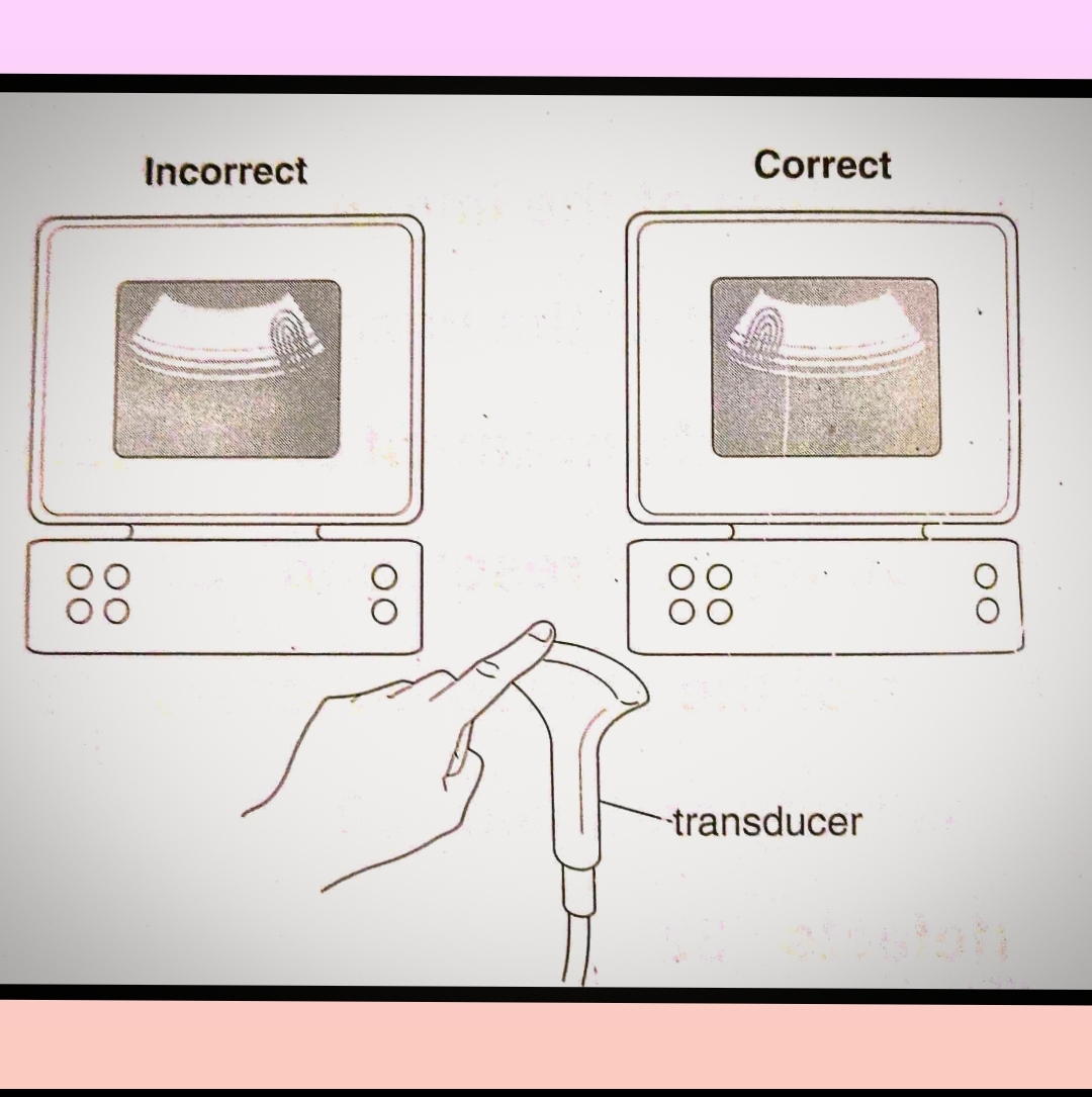 Ultrasound Scanning & Basic Rules