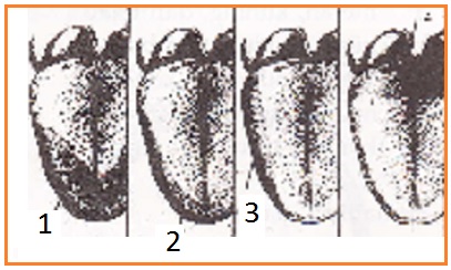 Soal Biologi Sistem Indera Biologi