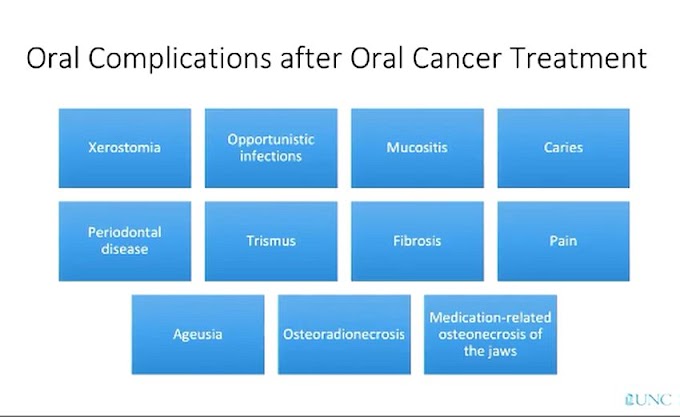 WEBINAR: ORAL CANCER - A Comprehensive Overview - Samid Patel MD FACS