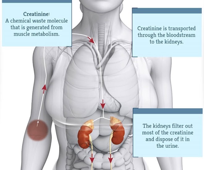 High Protein in Blood (Hyperproteinemia)
