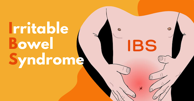 IRRITABLE BOWEL SYNDROME - TREATMENT, CAUSE, SYMPTOMS