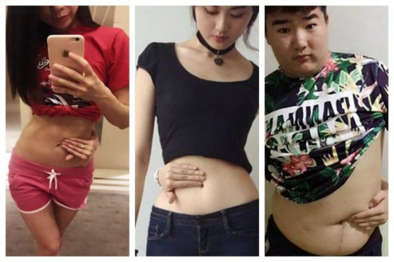 China Viral Weight Loss Trend, Medical experts raise concerns about 'Belly Button Challenge', 'Belly button challenge' goes viral on Chinese social media