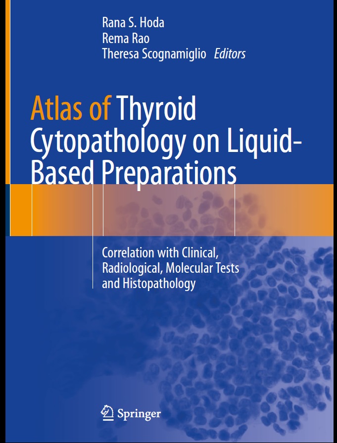 Atlas of Thyroid Cytopathology on Liquid Based Preparations