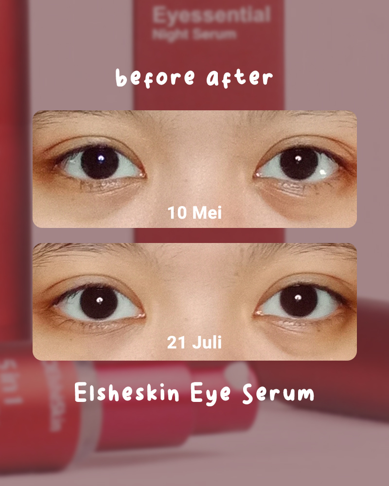 Review Elsheskin 5 in 1 Eyessential Night Serum b e l l a ' s