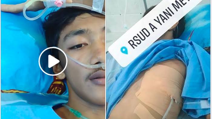 Viral, Kisah Seorang Pemuda yang Paru-Parunya Viral, Kisah Seorang Pemuda yang Paru-Parunya