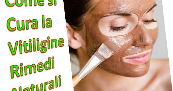 Eliminazione di laser di prezzo di lentiggini