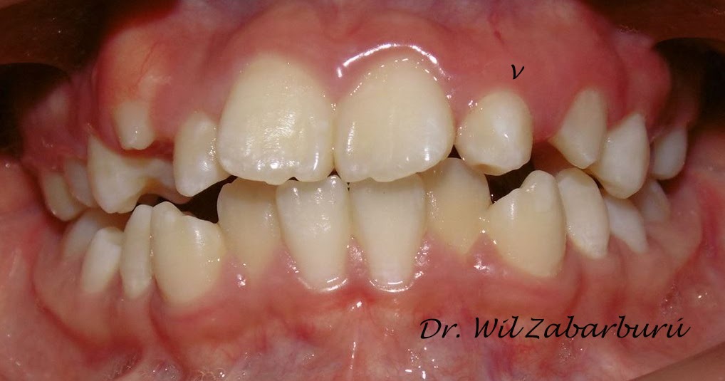 CLINICA DENTAL ASISTENCIAL DENS IN DENTE