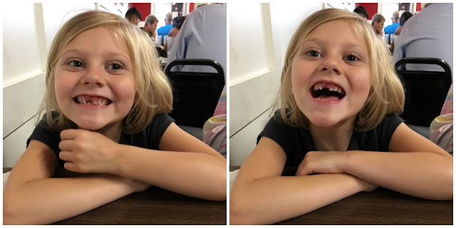 Stella without Her Front Tooth