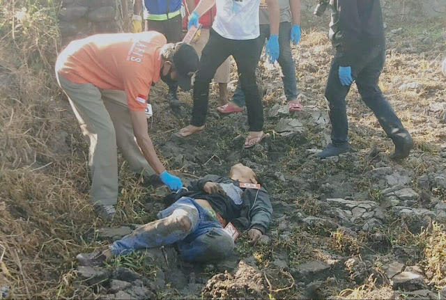 Pria ini Ditemukan Tewas dengan Usus Terburai, Apa Penyebabnya ?