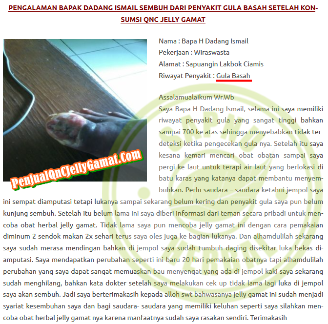 Cara Menyembuhkan Luka Borok Bernanah Dan Berair Secara Alami ~ Testimoni QnC Jelly Gamat Cara Menyembuhkan Luka Borok Bernanah Dan Berair Secara Alami ~ Testimoni QnC Jelly Gamat