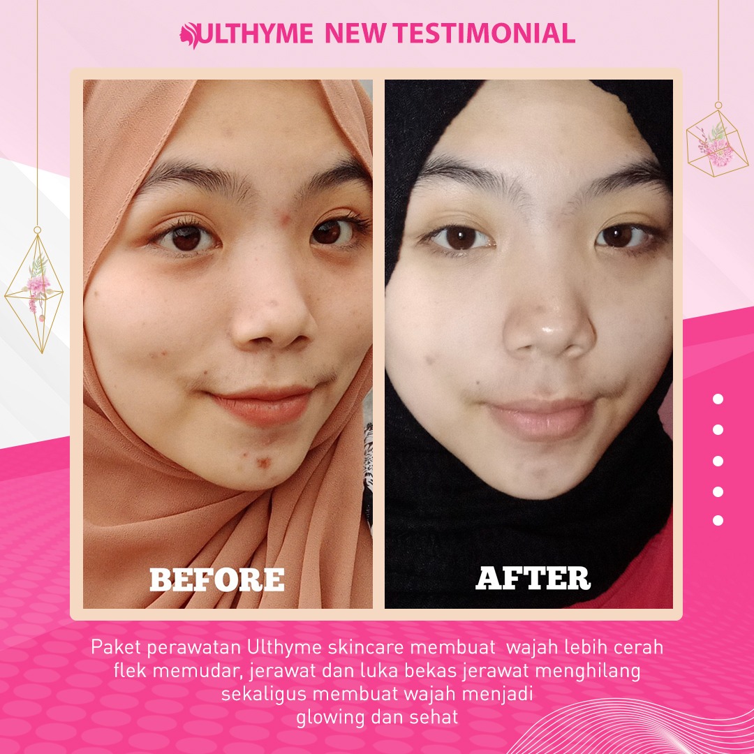 ulthyme skincare