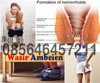 Salep Khusus Untuk Sakit Wasir (Hemoroid)