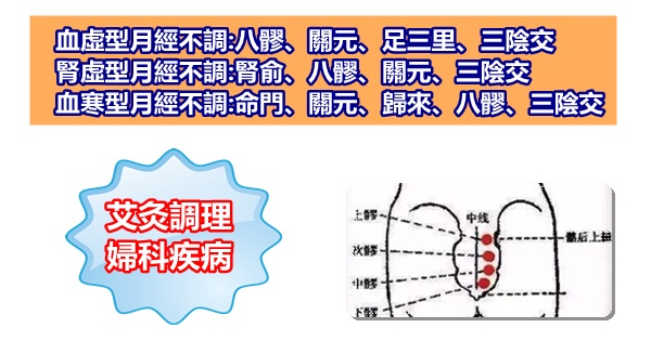痛經、宮寒、婦科炎症、皺紋......艾灸調理婦科疾病常用穴位！(失眠、便秘)