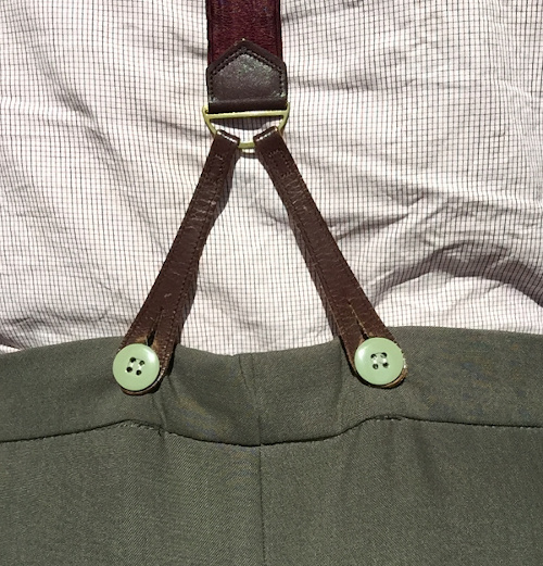 Everything About Braces Placement of Brace Buttons