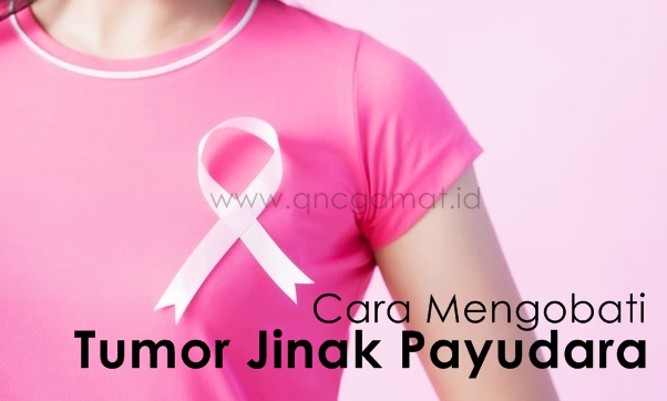 Cara Mengobati Tumor Jinak Payudara Secara Alami