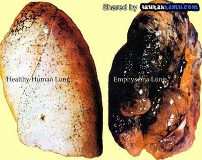 Tips Membersihkan Paru Paru - Fajar Siagian | Blogger Medan