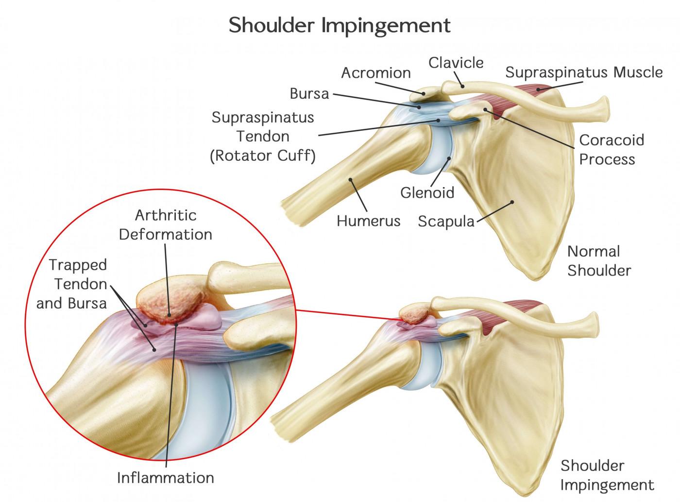 medicamente pentru tratamentul osteochondrozei gâtului