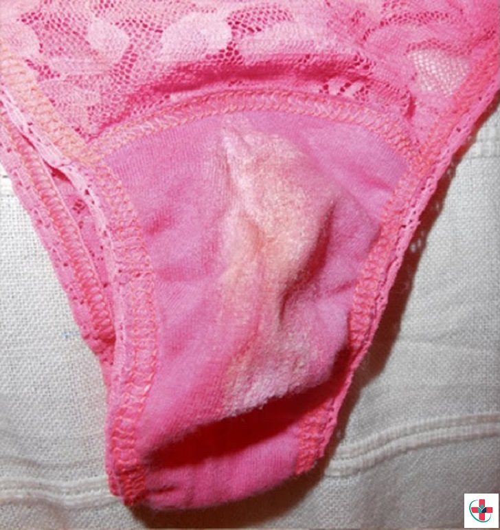 Woman underwear with discharge
