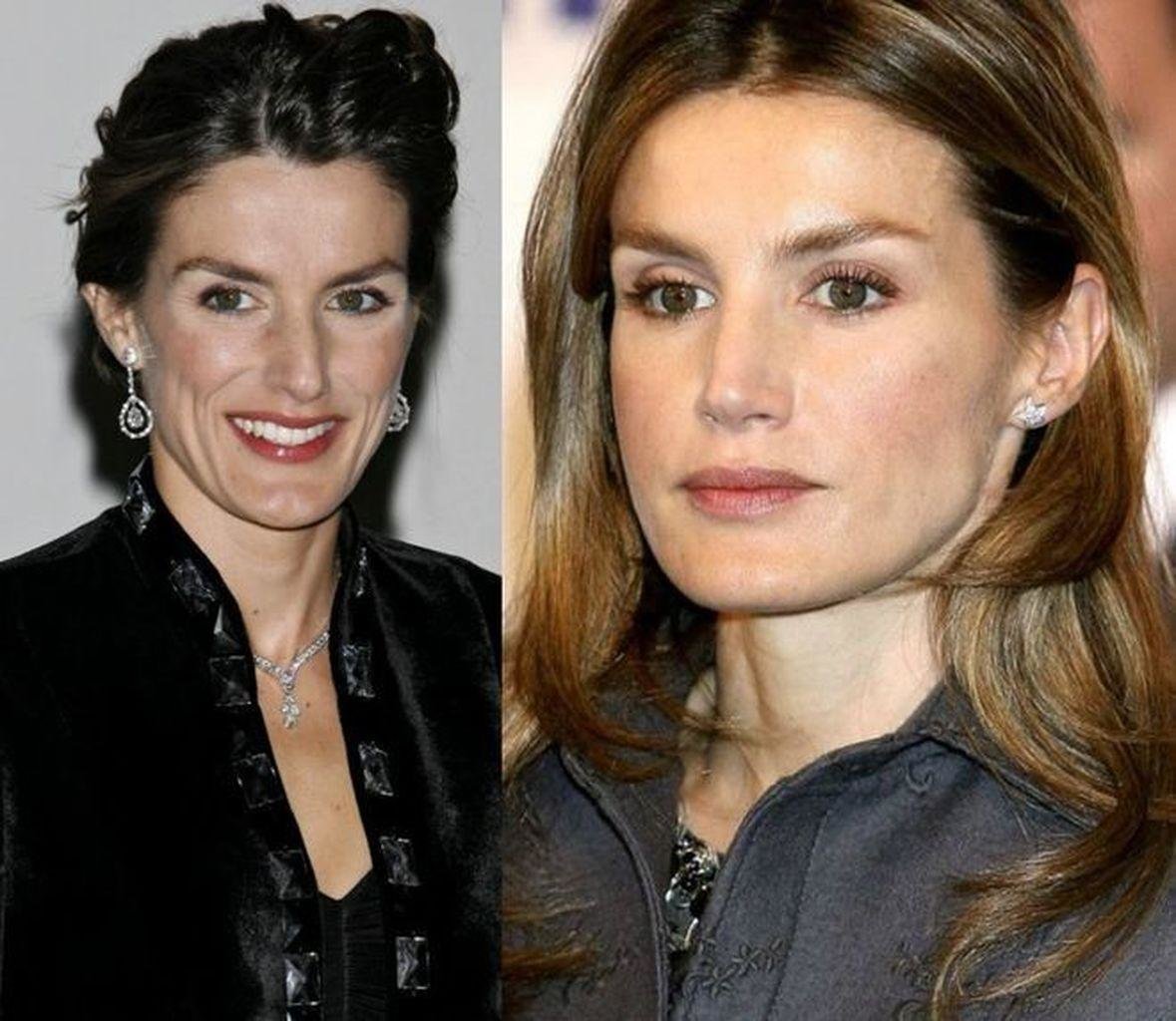 Letizia%2BOrtiz%2BPlastic%2BSurgery.jpg