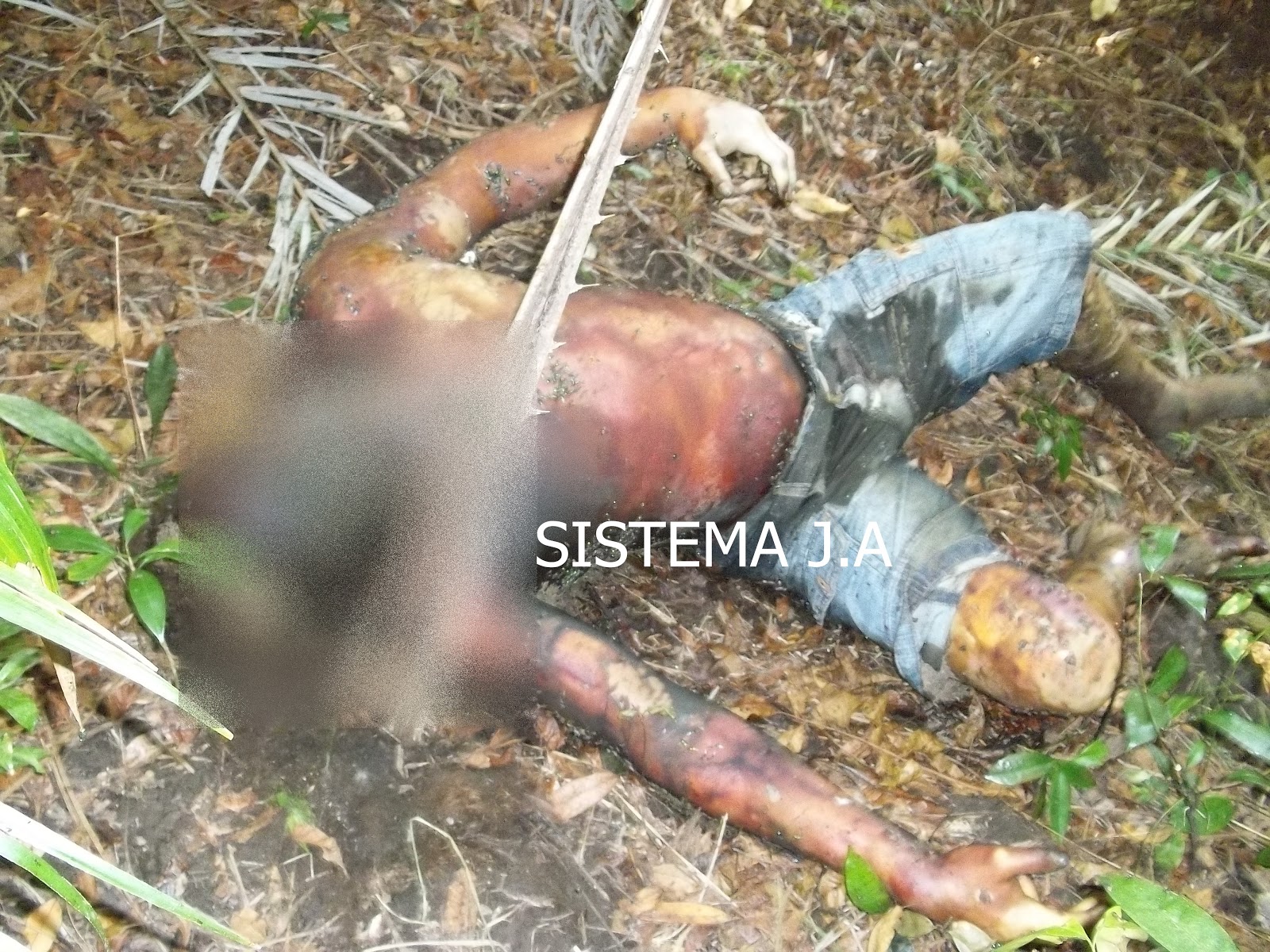 Encontrado Em Vários órgãos Ocos Do Corpo