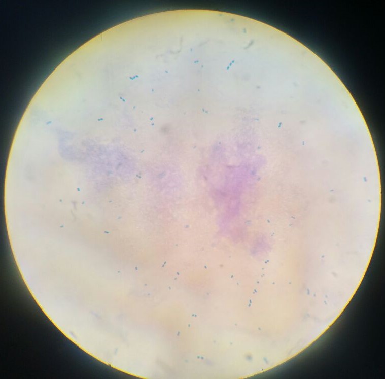 MICROBIOLOGÍA TINCIÓN SIMPLE CON AZUL DE METILENO MICROBIOLOGÍA TINCIÓN SIMPLE CON AZUL DE METILENO
