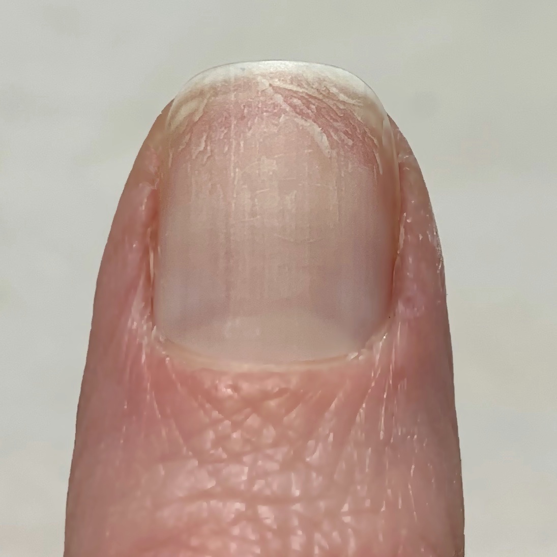 Never Enough Nails Zoya Naked Manicure Rescue + Repair Kit Review