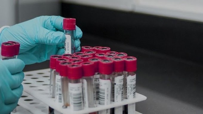 Κορονοϊός: "Βράζει" η Αττική - Σε ποιες περιοχές εντοπίστηκαν τα 427 νέα κρούσματα 