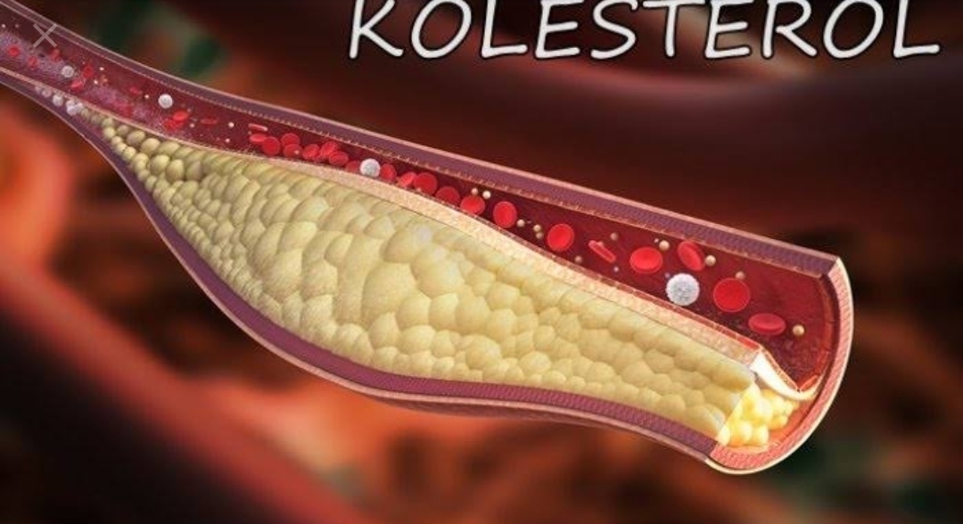 Pengertian dan Jenis jeni Kolesterol 